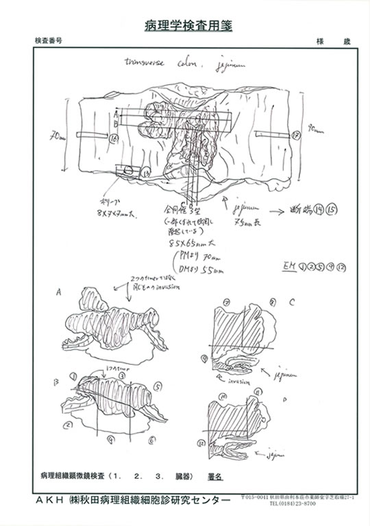 病理学検査用1