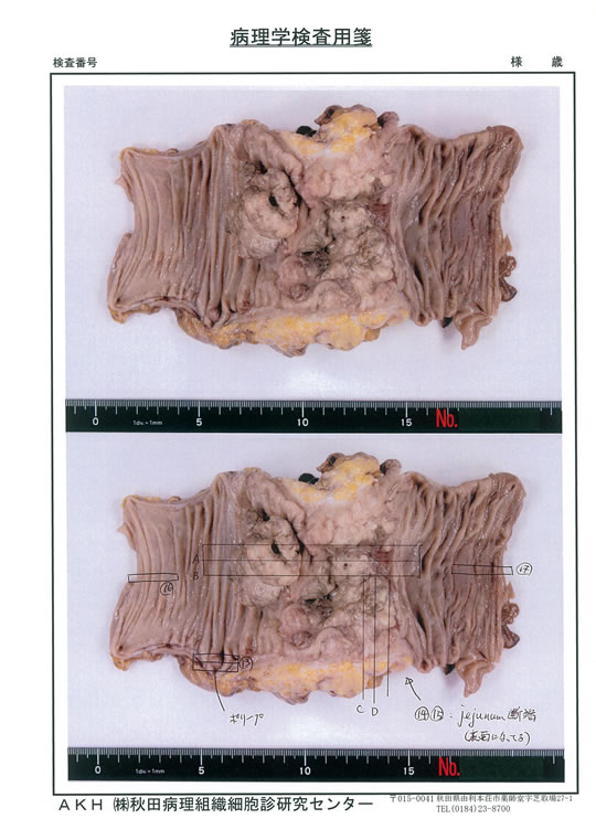 病理学検査用2