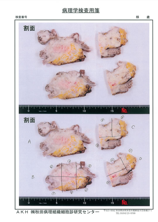 病理学検査用3
