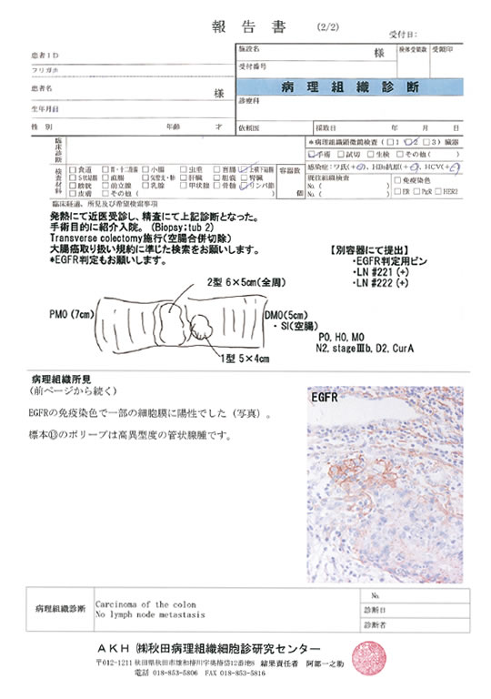 報告書2